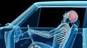 Herniated Disc From Car Accident
