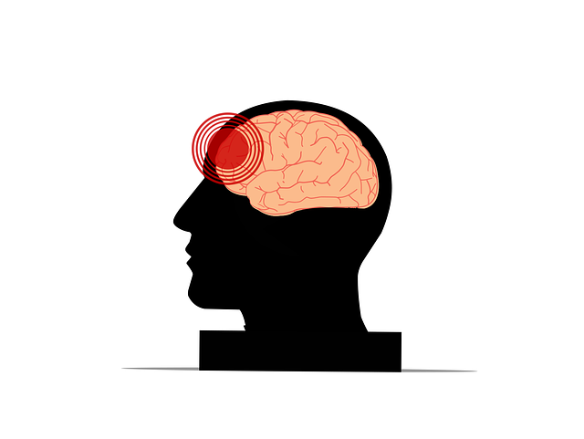 headache, brain, head